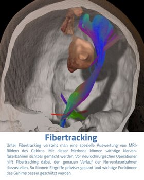 Fibertracking Aufnahme