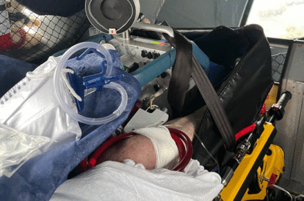 angeschlossenes ECMO